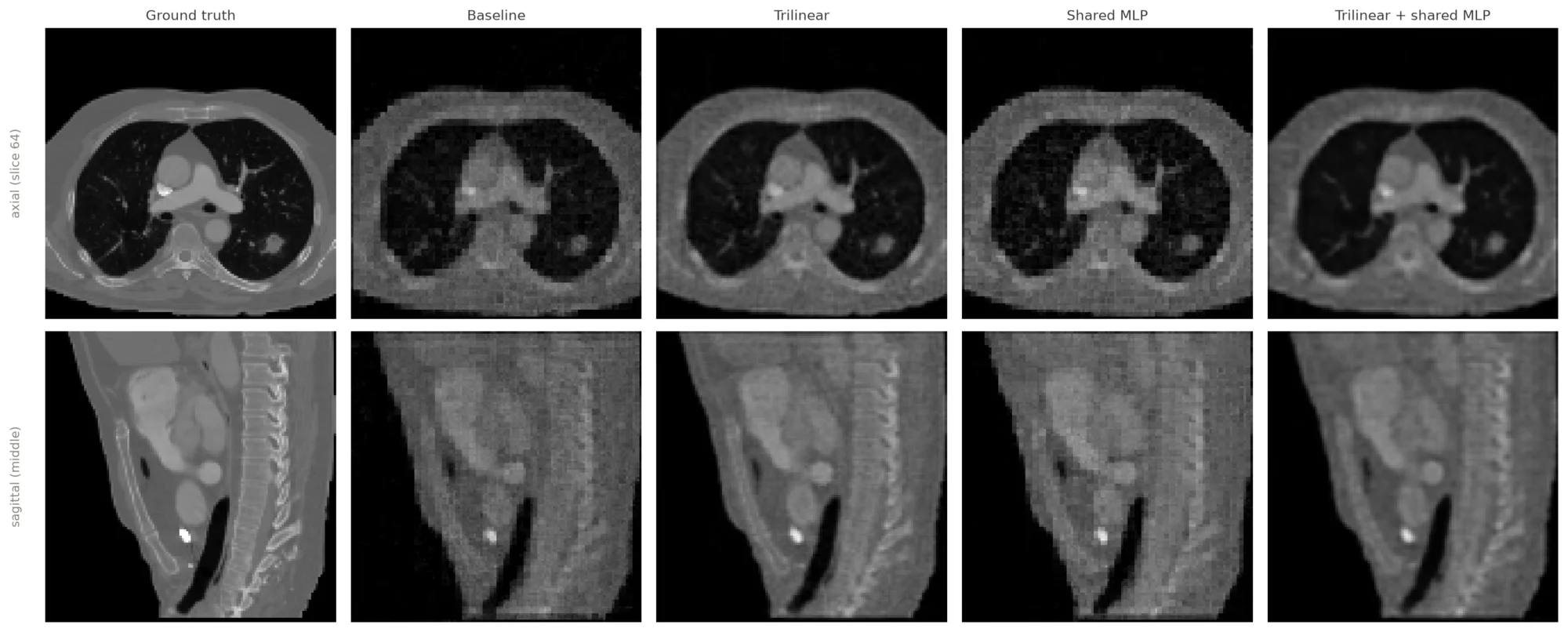 Axial and sagittal chest CT slices comparing ground truth with baseline, trilinear and shared-MLP reconstructions
